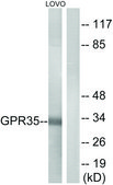 Anti-GPR35 antibody produced in rabbit affinity isolated antibody
