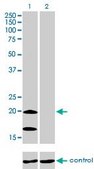 Monoclonal Anti-NDUFS4 antibody produced in mouse clone 1A1, purified immunoglobulin, buffered aqueous solution