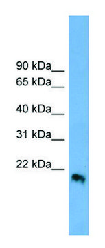 Anti-IFNB1 antibody produced in rabbit affinity isolated antibody