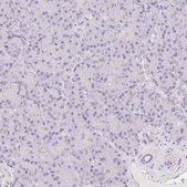 Anti-CTNND2 antibody produced in rabbit Prestige Antibodies&#174; Powered by Atlas Antibodies, affinity isolated antibody, buffered aqueous glycerol solution