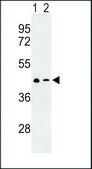 ANTI-CXCR7 (C-TERM) antibody produced in rabbit IgG fraction of antiserum, buffered aqueous solution