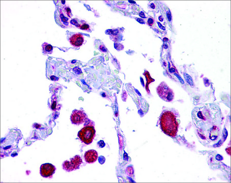 Anti-EIF2AK1 antibody produced in rabbit affinity isolated antibody