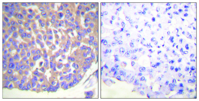 Anti-Filamin A antibody produced in rabbit affinity isolated antibody