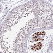 Anti-ZNF746 antibody produced in rabbit Prestige Antibodies&#174; Powered by Atlas Antibodies, affinity isolated antibody, buffered aqueous glycerol solution
