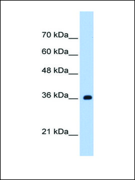 Anti-TRSPAP1 antibody produced in rabbit IgG fraction of antiserum