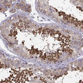 Anti-ELOVL5 antibody produced in rabbit Prestige Antibodies&#174; Powered by Atlas Antibodies, affinity isolated antibody, buffered aqueous glycerol solution
