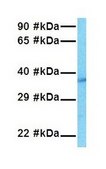 Anti-WNT1 antibody produced in rabbit affinity isolated antibody