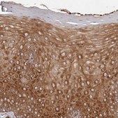 Anti-RPS6 antibody produced in rabbit Prestige Antibodies&#174; Powered by Atlas Antibodies, affinity isolated antibody, buffered aqueous glycerol solution