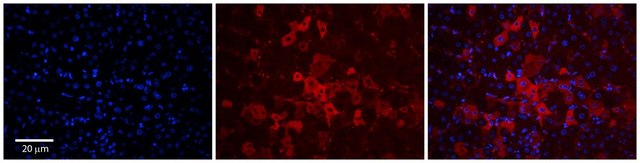 Anti-SLCO1A2 antibody produced in rabbit affinity isolated antibody