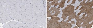 Anti-Myosin Heavy Chain 7 Antibody, clone 1B19, ZooMAb&#174; Rabbit Monoclonal recombinant, expressed in HEK 293 cells