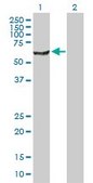 Anti-NARS antibody produced in rabbit purified immunoglobulin, buffered aqueous solution