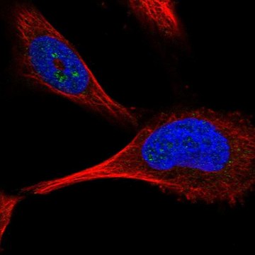 Anti-PFKFB4 antibody produced in rabbit Prestige Antibodies&#174; Powered by Atlas Antibodies, affinity isolated antibody