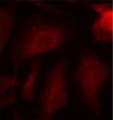 Anti-Phospho-Tau-S404 antibody produced in rabbit