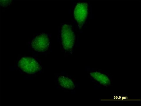 Anti-RECQL5 antibody produced in mouse purified immunoglobulin, buffered aqueous solution