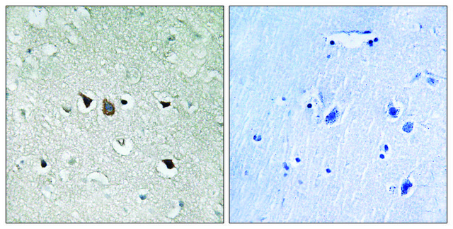 Anti-C-RAF antibody produced in rabbit affinity isolated antibody
