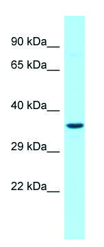 Anti-G6PC3 (N-terminal) antibody produced in rabbit affinity isolated antibody