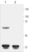 Anti-Potassium Channel KIR6.1 antibody produced in rabbit affinity isolated antibody, lyophilized powder