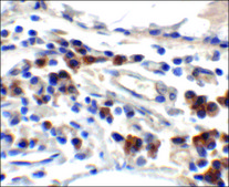 Anti-TFF3 antibody produced in rabbit affinity isolated antibody, buffered aqueous solution