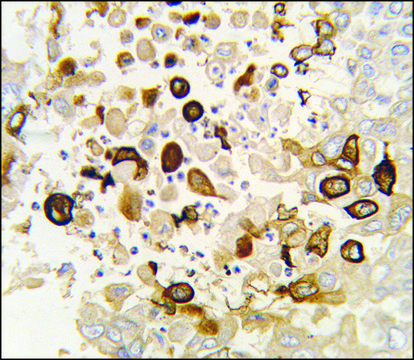 Anti-CYP4X1 (N-term) antibody produced in rabbit saturated ammonium sulfate (SAS) precipitated, buffered aqueous solution