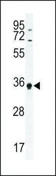 ANTI-ECAT1(N-TERMINAL) antibody produced in rabbit affinity isolated antibody, buffered aqueous solution