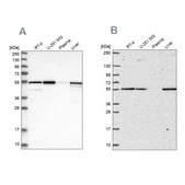 Anti-PMPCA antibody produced in rabbit Prestige Antibodies&#174; Powered by Atlas Antibodies, affinity isolated antibody, buffered aqueous glycerol solution