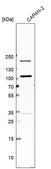 Anti-PIBF1 antibody produced in rabbit Prestige Antibodies&#174; Powered by Atlas Antibodies, affinity isolated antibody
