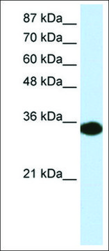 Anti-HOXD4 (AB1) antibody produced in rabbit affinity isolated antibody