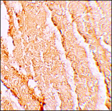 Anti-VPS39 antibody produced in rabbit affinity isolated antibody