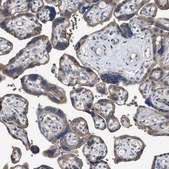 Anti-UPF1 antibody produced in rabbit Prestige Antibodies&#174; Powered by Atlas Antibodies, affinity isolated antibody, buffered aqueous glycerol solution, Ab2