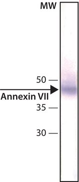 Anti-Annexin VII antibody, Mouse monoclonal clone 203-217/6, purified from hybridoma cell culture