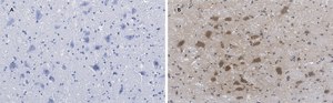 Anti-Choline Acetyltransferase (ChAT) Antibody, clone 2K16, ZooMAb&#174; Rabbit Monoclonal recombinant, expressed in HEK 293 cells