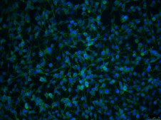 OSUMMER.1 Mouse NRAS-Mutant Melanoma Cell Line