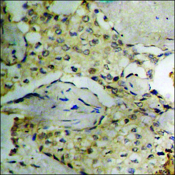 Anti-phospho-Synuclein-&#945; (pTyr136) antibody produced in rabbit affinity isolated antibody