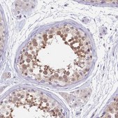 Anti-PDE6D antibody produced in rabbit Prestige Antibodies&#174; Powered by Atlas Antibodies, affinity isolated antibody, buffered aqueous glycerol solution