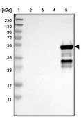 Anti-CYP2C9 antibody produced in rabbit Prestige Antibodies&#174; Powered by Atlas Antibodies, affinity isolated antibody, buffered aqueous glycerol solution