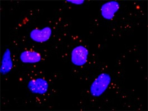 Anti-HIP1 antibody produced in rabbit purified immunoglobulin, buffered aqueous solution