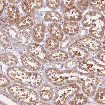 Anti-TPD52L2 antibody produced in rabbit Prestige Antibodies&#174; Powered by Atlas Antibodies, affinity isolated antibody, buffered aqueous glycerol solution