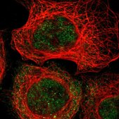 Anti-MAST4 antibody produced in rabbit Prestige Antibodies&#174; Powered by Atlas Antibodies, affinity isolated antibody, buffered aqueous glycerol solution