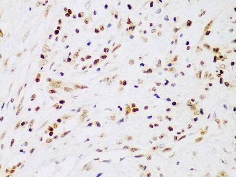 Anti-IKK beta antibody produced in rabbit