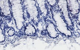 Anti-Heparan Sulfate Antibody, clone T320.11 ZooMAb&#174; Mouse Monoclonal recombinant, expressed in HEK 293 cells