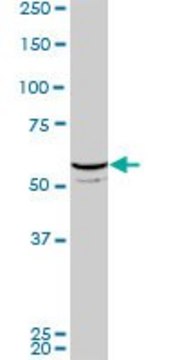 ANTI-FLI1 antibody produced in mouse clone 2D6, purified immunoglobulin, buffered aqueous solution