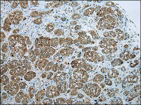 Anti-SSX2 affinity isolated antibody