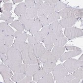 Anti-CDKN2B antibody produced in rabbit Prestige Antibodies&#174; Powered by Atlas Antibodies, affinity isolated antibody, buffered aqueous glycerol solution