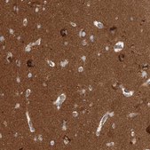 Anti-WDR37 antibody produced in rabbit Prestige Antibodies&#174; Powered by Atlas Antibodies, affinity isolated antibody, buffered aqueous glycerol solution
