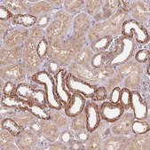 Anti-PALM antibody produced in rabbit Prestige Antibodies&#174; Powered by Atlas Antibodies, affinity isolated antibody, buffered aqueous glycerol solution