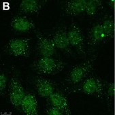 Anti-Linear Ubiquitin Antibody, clone 1E3 ZooMAb&#174; Rabbit Monoclonal recombinant, expressed in HEK 293 cells