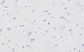 Anti-K+/Cl- Cotransporter-2 Antibody, clone 5E13 ZooMAb&#174; Rabbit Monoclonal recombinant, expressed in HEK 293 cells