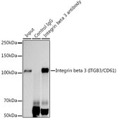 Anti-Integrin beta 3 (ITGB3/CD61) Antibody, clone 7D5N1, Rabbit Monoclonal