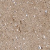 Anti-SLC38A2 antibody produced in rabbit Prestige Antibodies&#174; Powered by Atlas Antibodies, affinity isolated antibody, buffered aqueous glycerol solution