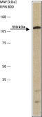 Anti-Androgen Receptor antibody produced in rabbit affinity isolated antibody, buffered aqueous solution